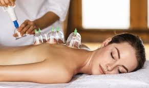 Cupping Therapy